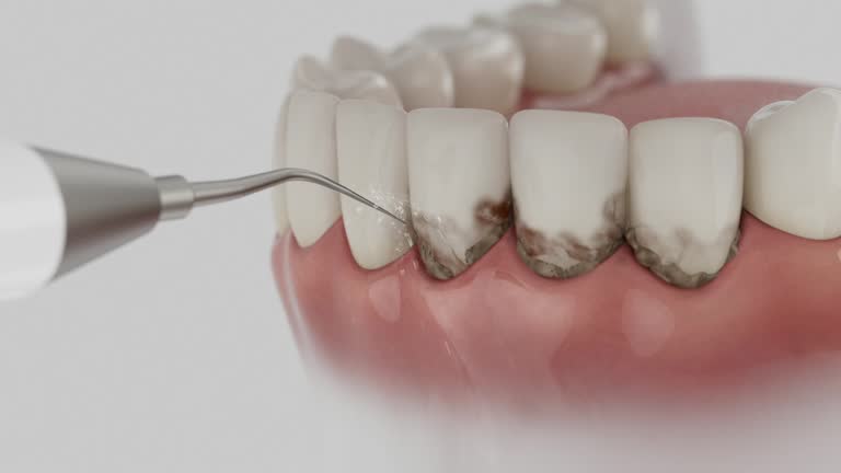 Trusted Teeth Cleaning And Checkup service in St. Georges, DE - Dentist Open Now